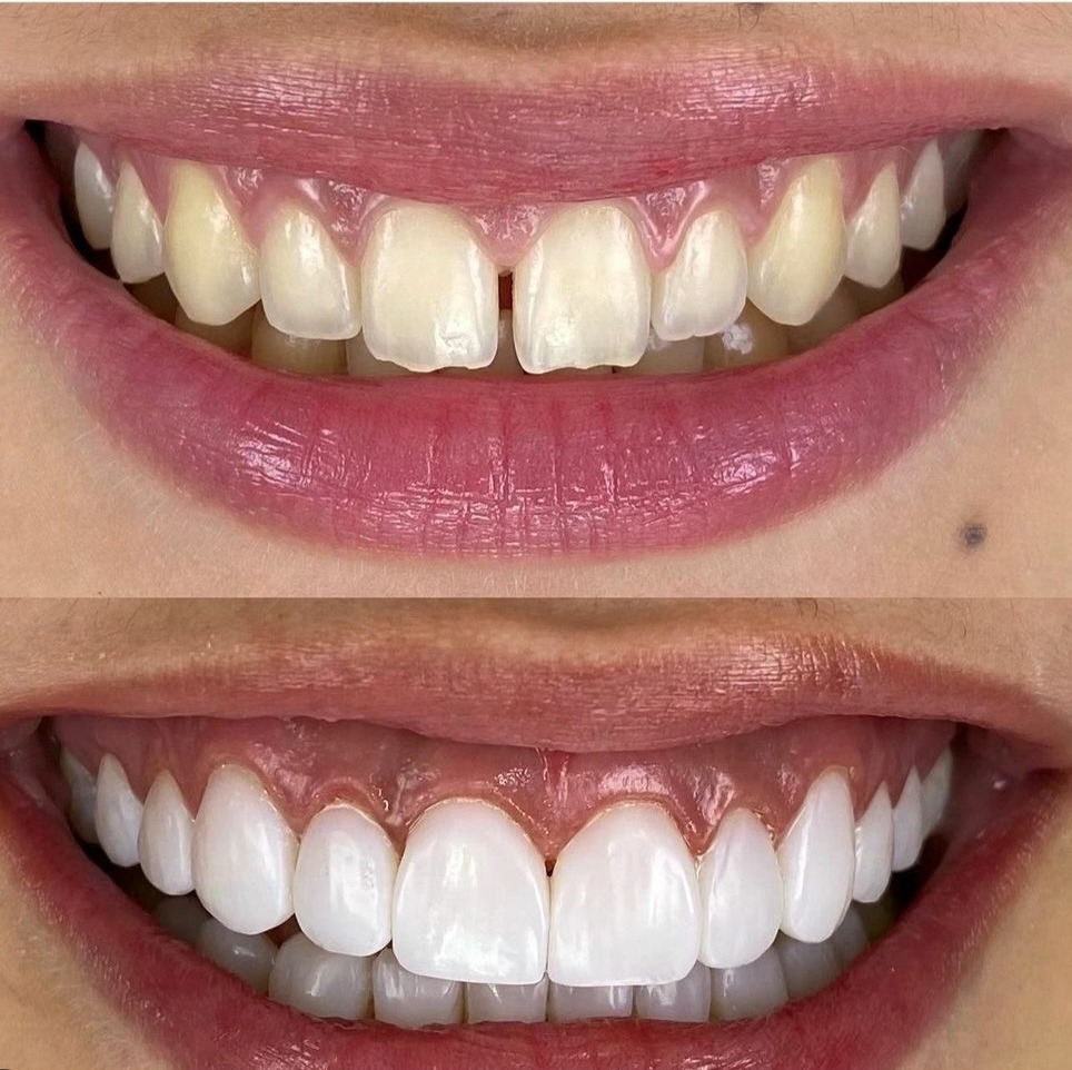 cosmetic-dentistry