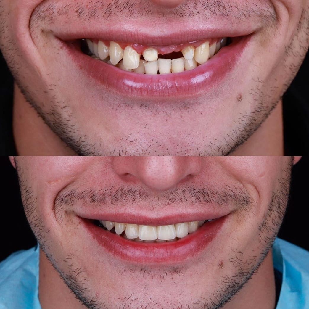 dental-prosthetics
